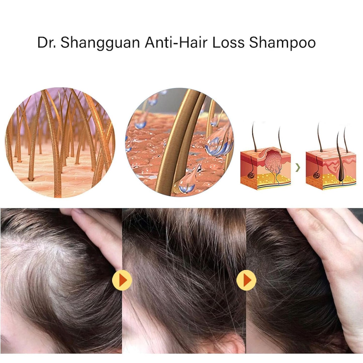Anti-Hair Loss & Hair Growth Shampoo